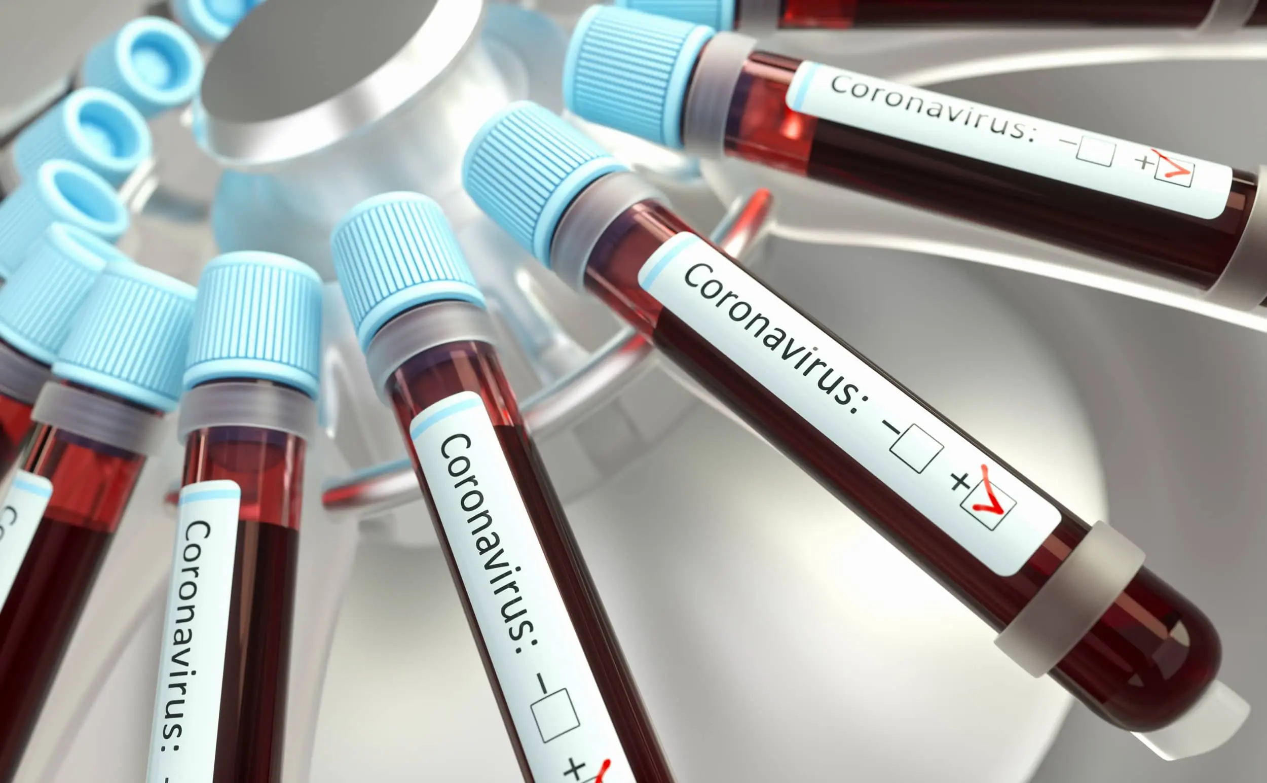 Coronavirus - © ktsimage